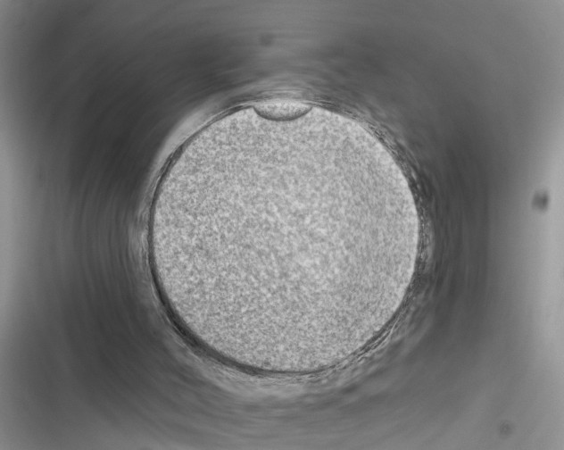 X0000116630004201001221410