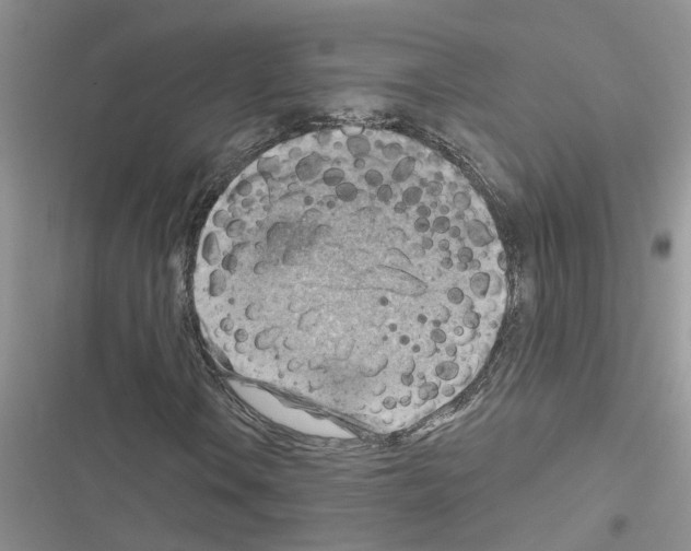 X0000116631106201001221355