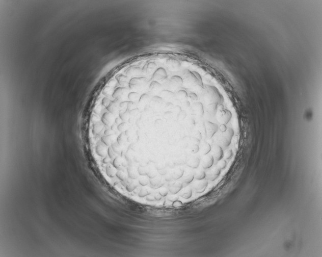 X0000116631404201001221351
