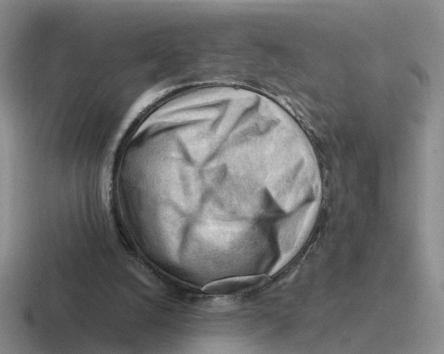 X0000116640056201001041039