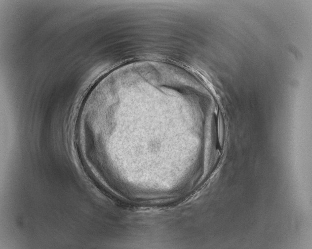 X0000116640145201001041037