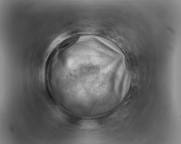 X0000116640296201001041036