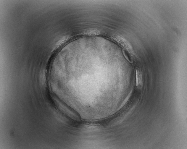 X0000116640300201001041036