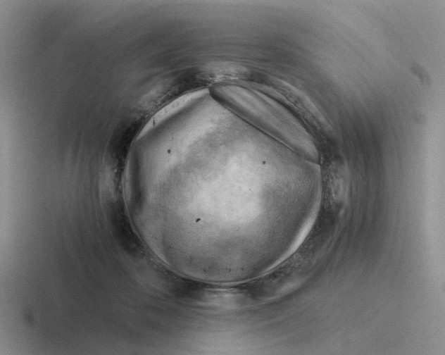 X0000116640316201001041036