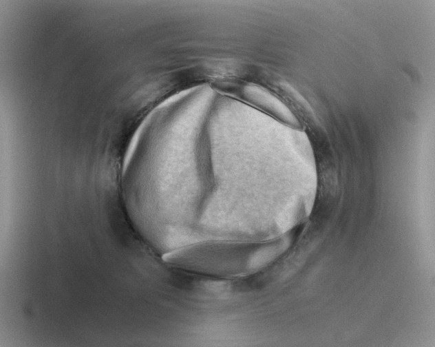 X0000116640325201001041036