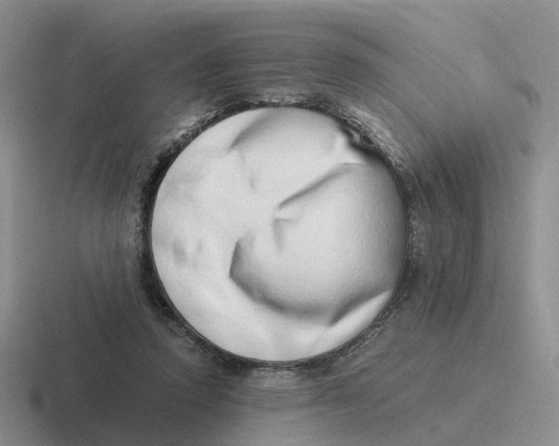 X0000116640354201001041035