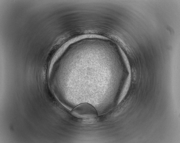 X0000116640357201001041035