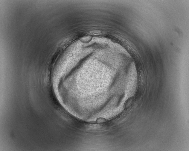 X0000116640361201001041035