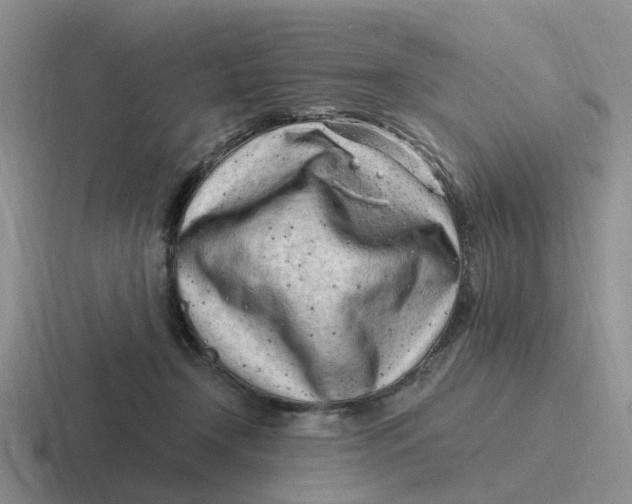 X0000116640366201001041035