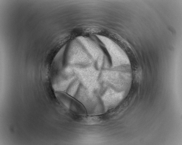 X0000116640517201001041033