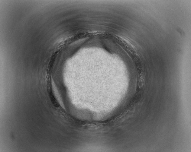 X0000116640917201001041028