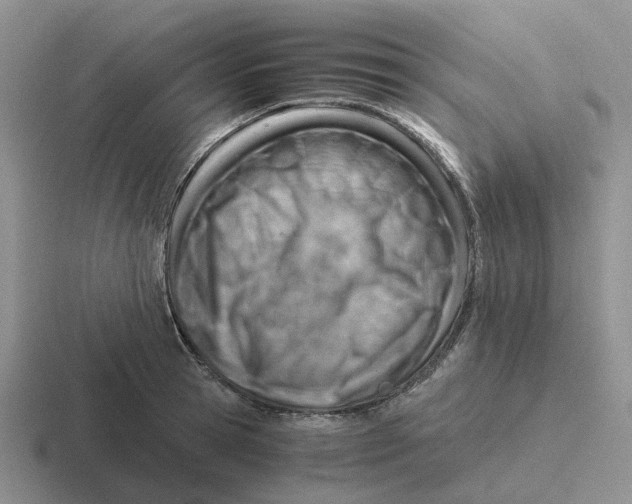 X0000116640945201001041028