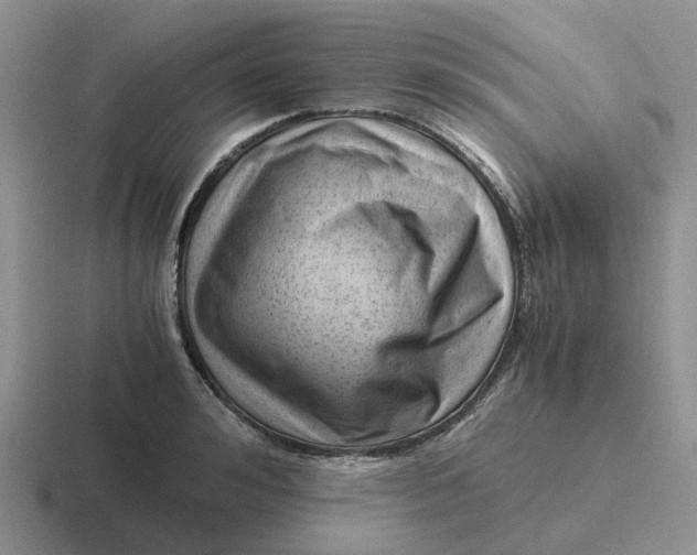 X0000116640992201001041027