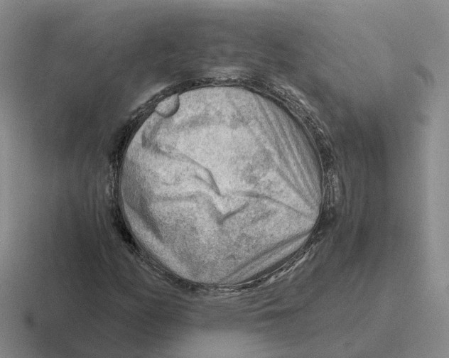 X0000116641158201001041025