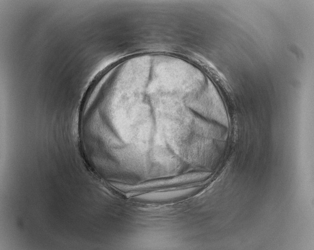 X0000116641174201001041025