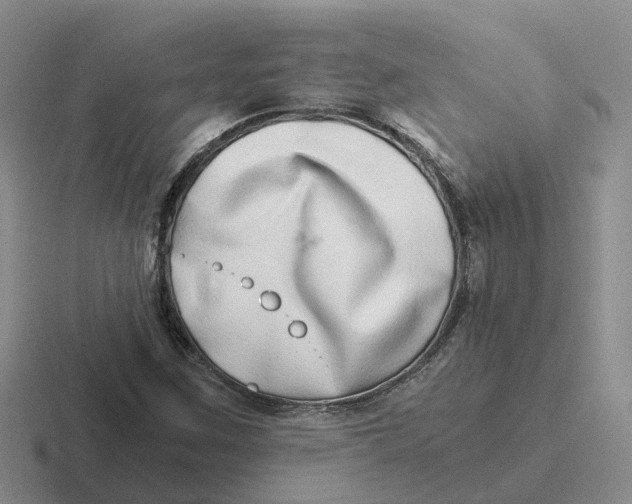 X0000116641259201001041024