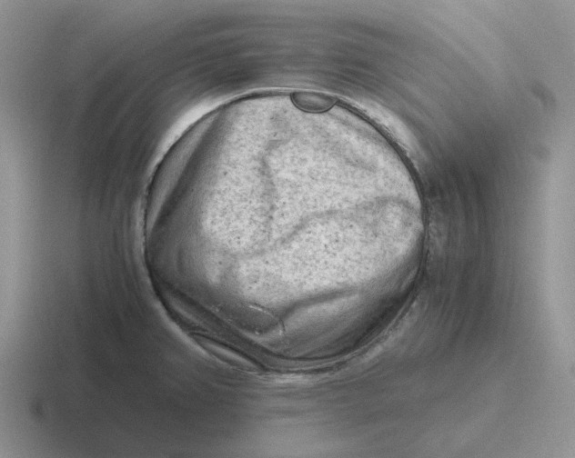 X0000116641382201001041022