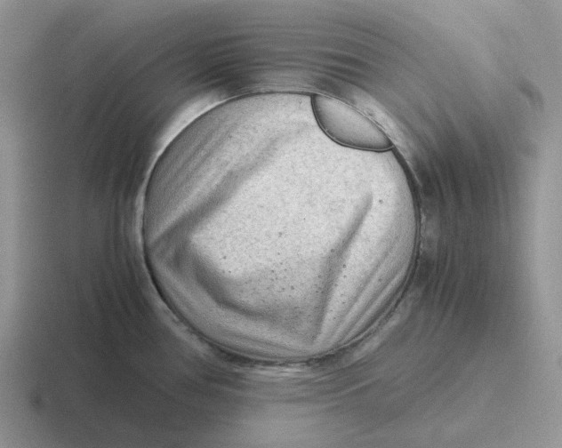 X0000116641386201001041022