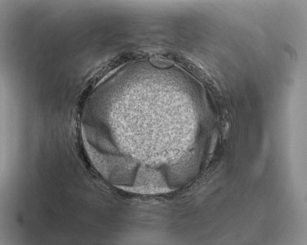 X0000116641397201001041022