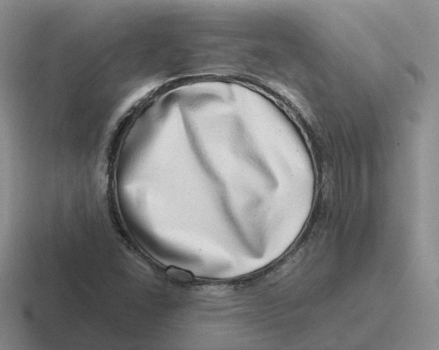 X0000116641406201001041022