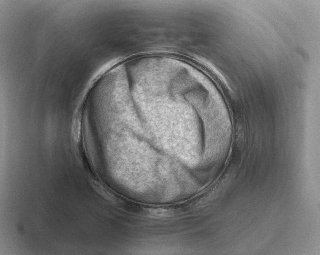 X0000116641413201001041022