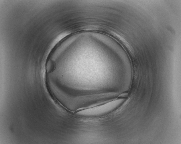 X0000116641418201001041022