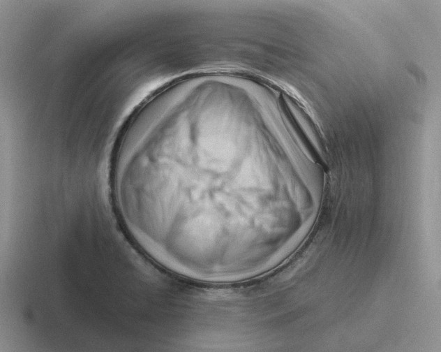 X0000116641422201001041022