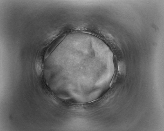 X0000116641444201001041022