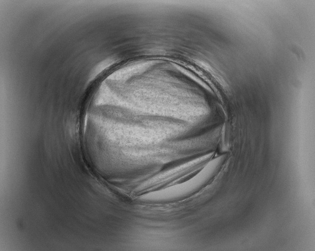 X0000116641450201001041021