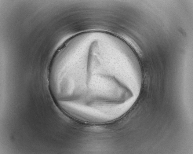 X0000116641476201001041021