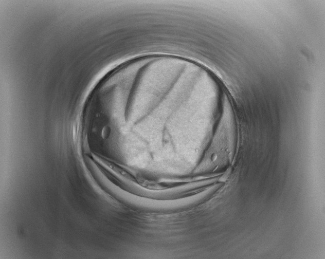 X0000116641515201001041021