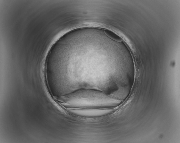 X0000116641381201001111159