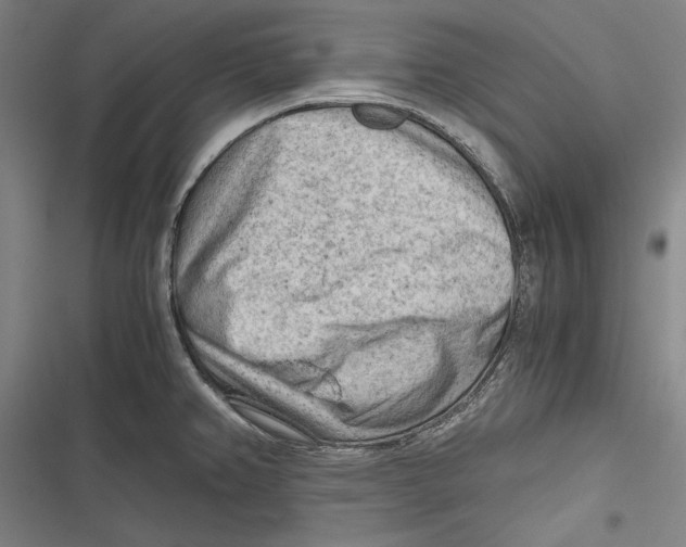 X0000116641382201001111159