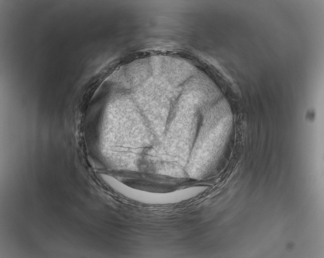 X0000116641399201001111158