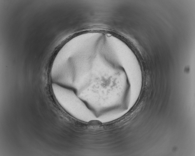 X0000116641407201001111158