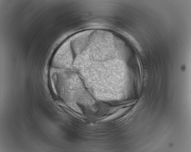 X0000116641419201001111158