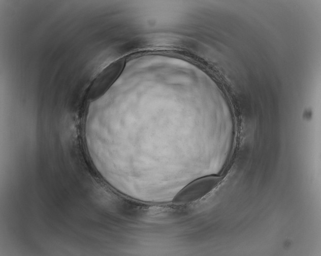 X0000116641449201001111158