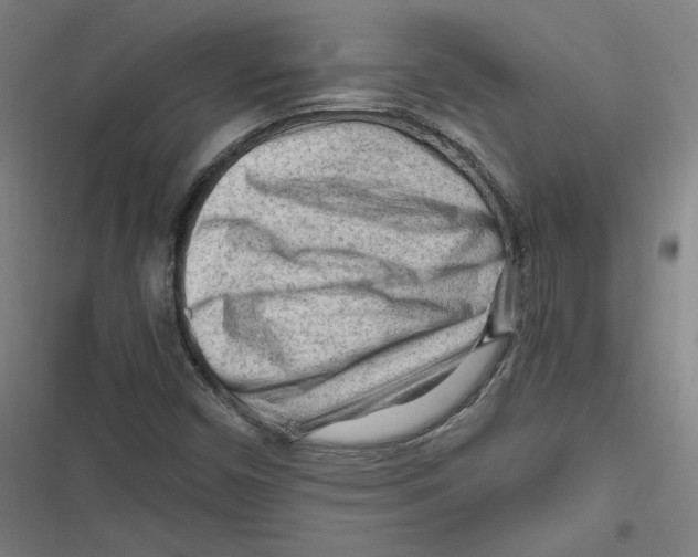 X0000116641450201001111158