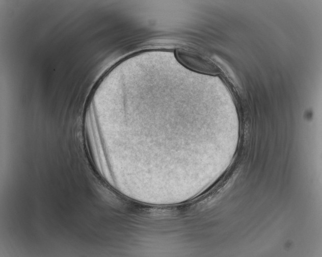 X0000116641465201001111158