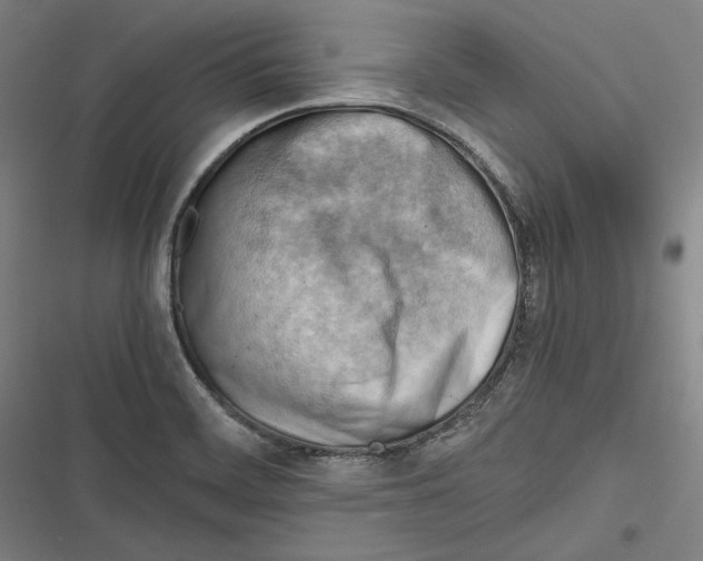 X0000116641468201001111158