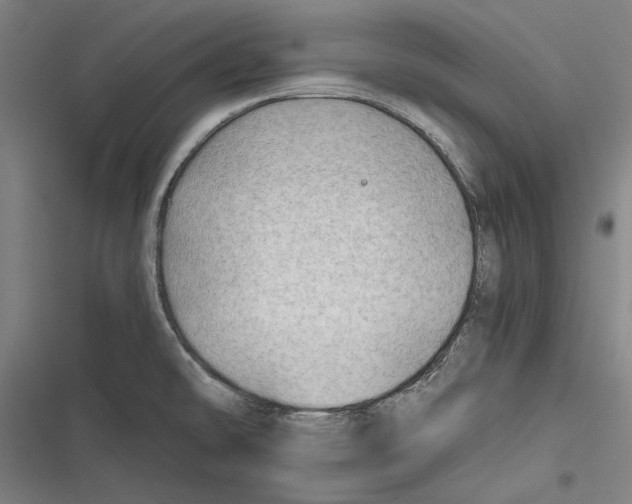 X0000116641478201001111158