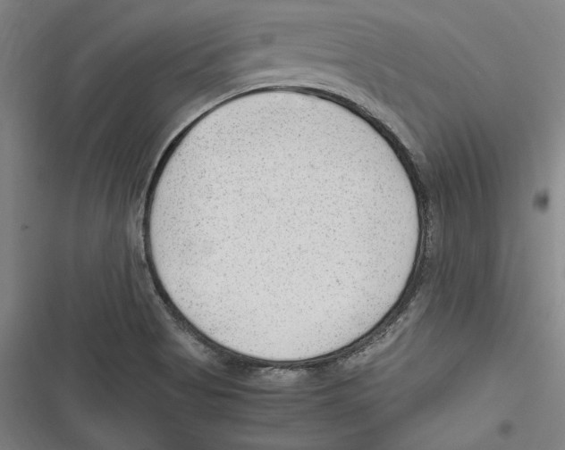 X0000116641513201001111157