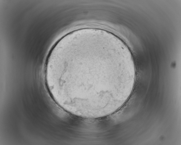 X0000116641514201001111157