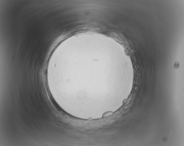 X0000116640003201001251145