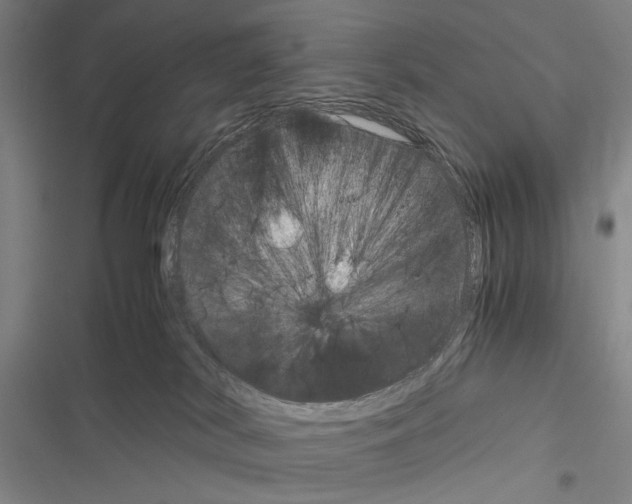 X0000116640038201001251145