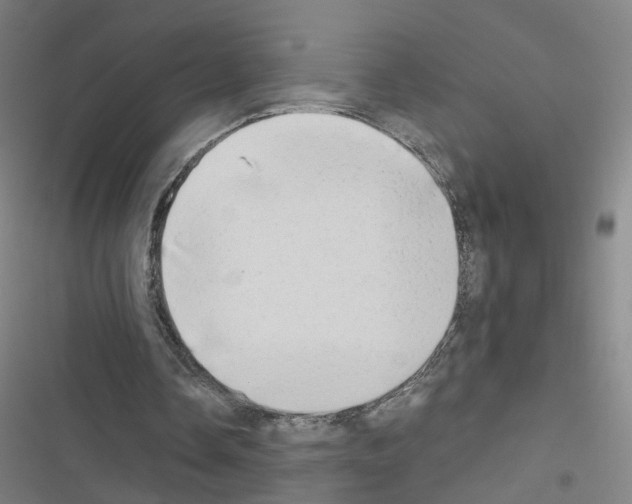 X0000116640338201001251140