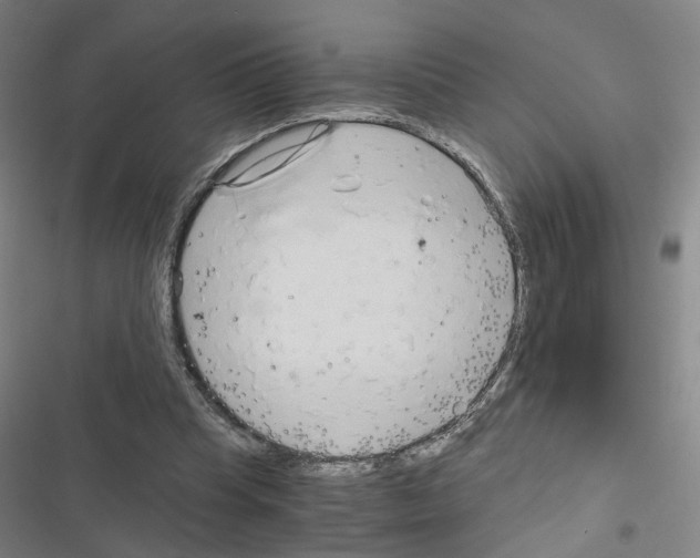 X0000116640345201001251140