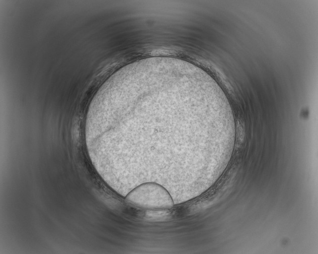 X0000116640357201001251141