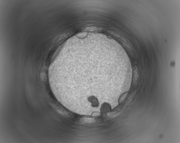 X0000116640361201001251141