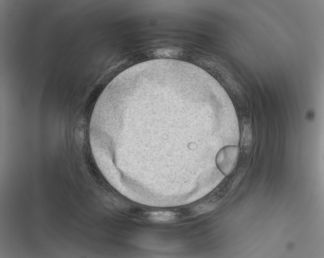 X0000116640363201001251141